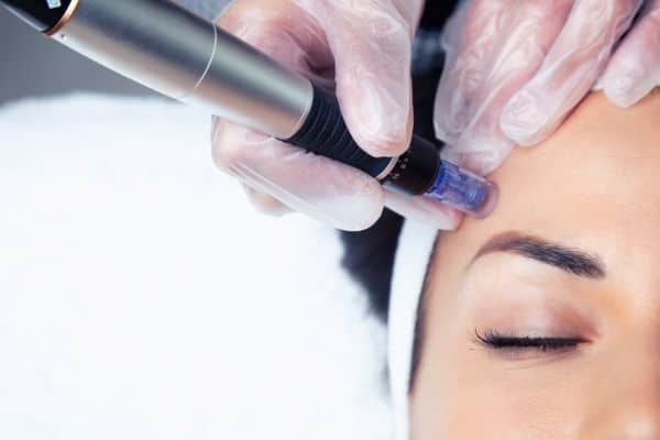 Explaining Total Skin Tightening Treatment and What to Expect 2 What Skin Concerns Can Total Skin Tightening Treatment Help With Eaton?